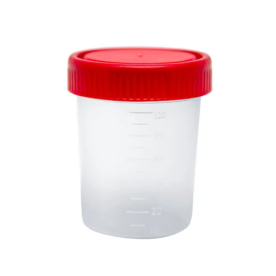 VASOS DE MUESTRAS DE ORINA